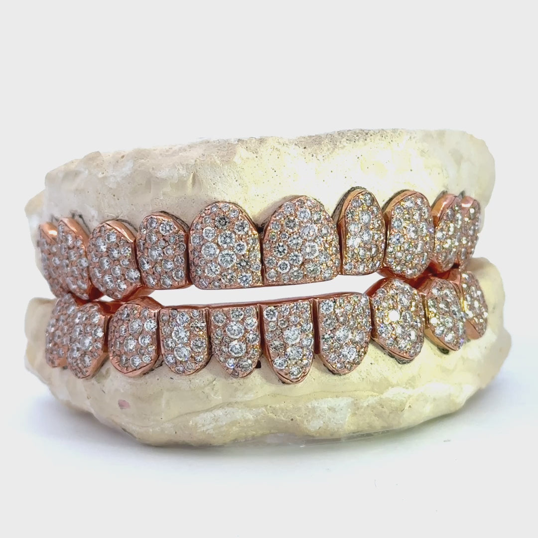 New Mosaic Setting Grillz